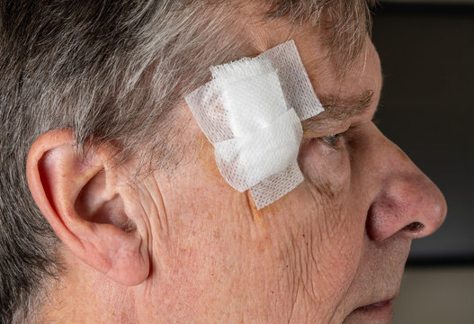 Senior adult male with dressings on surgery for removal of basal cell carcinoma caused by sun damage