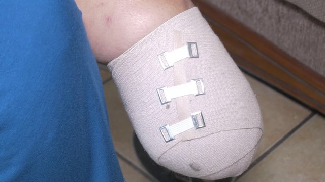 Amputated elderly woman sitting and holding hands in a  wheelchair.