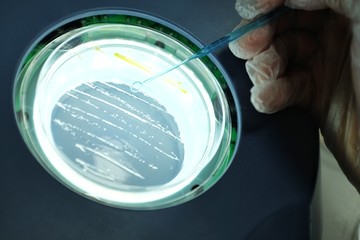 Working on bacteria growth on agar