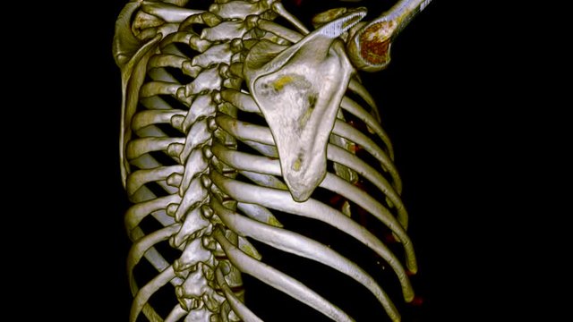 A 3D CT scan of the bones of a male torso, realistic 3D reconstruction. Medical concept, animation loop.