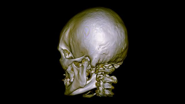 A 3D CT scan of a male skull. 3D Model of a skull, Close Up. Hospital equipment makes A 3D Model of a man. Seamless loop animation