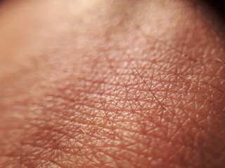 macro skin of human hand.Medicine and dermatology concept. Details of human skin background.