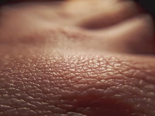 macro skin of human hand.Medicine and dermatology concept. Details of human skin background. - 302422603