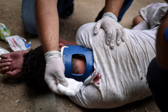 Paramedics Providing First Aid Assistance To A Collapsed Person Presenting A Head Injury