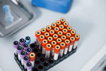 Top view of vials with medical experimental liquid that stands on white surface