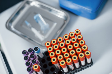 Top view of vials with medical experimental liquid that stands on white surface