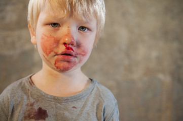 little fair-haired boy is smeared with blood. baby has weak vessels in nose bursting with pressure...