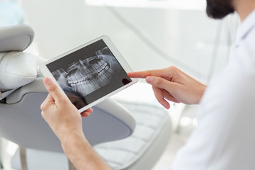 close up of Dentist showing x-ray on tablet screen in modern dental clinic