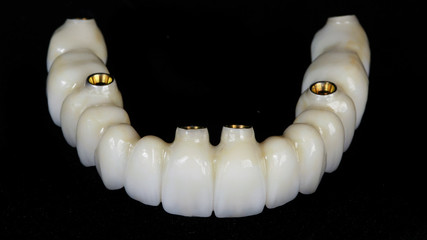 Fototapeta premium dental prosthesis made of zircon with fixation on six implants on black glass
