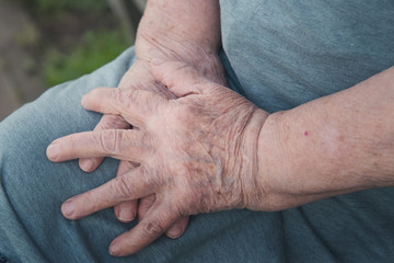 old woman's hands on her knee