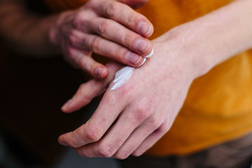 Ointment on the hands of an elderly person. Retired applying the ointment , creams in the treatment of eczema, psoriasis and other skin diseases