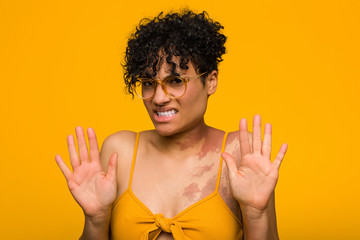 Young african american woman with skin birth mark rejecting someone showing a gesture of disgust.