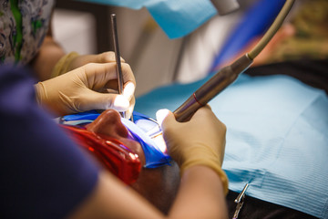 Treatment of the patient in the dentist's office close-up. The process of prosthetics and and the patient's mouth with dental instruments