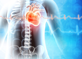 Human heart attack. Heart Disease. 3d illustration