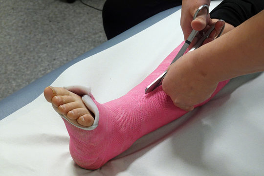 Nurse removing orthopedic cast from foot with bandage scissors.