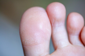 young girl's toes are healthy and beautiful.