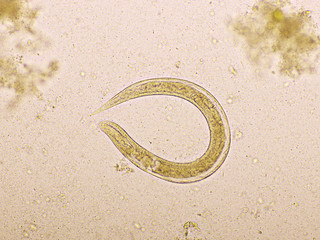 Strongyloides stercoralis or threadworm in human stool, analyze by microscope, original magnification 400x