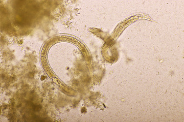 Strongyloides stercoralis or threadworm in human stool, analyze by microscope, original...
