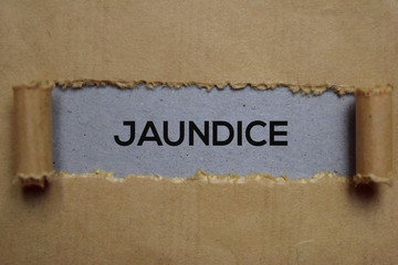 Jaundice Text written in torn paper. Medical concept