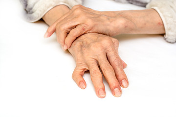 Fototapeta premium Treatment of rheumatoid arthritis. Hands.