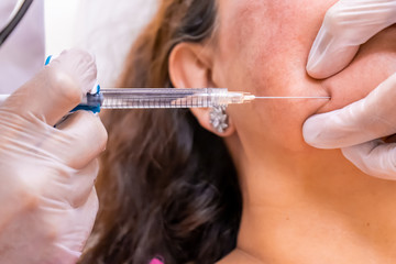 Gloved doctor hand injecting a vial of hyaluronic acid (HA) based dermal filler into patient for a non-surgical chin, mouth and face lift.