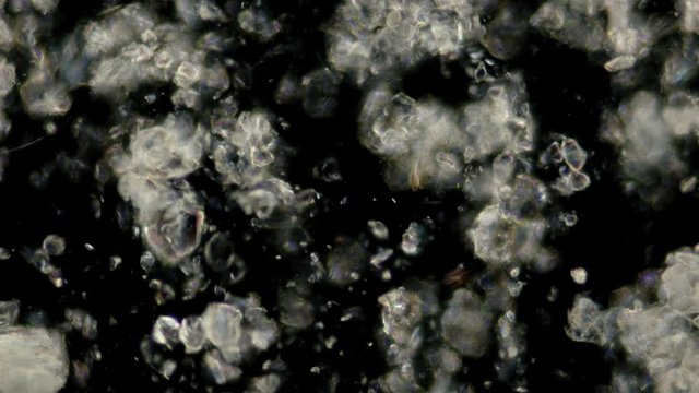 the motion of scorbutus crystals under a microscope, an alcoholic solution of ascorbic acid, the chaotic movement of crystals is visible, the very formula C6H8O6
