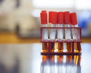 Broth for growing different bacteria.