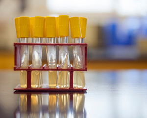 Agar slant for growing microorganisms.