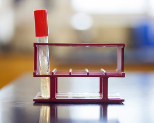 Bacteria growing on an agar slant.