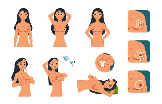 Breast exam. Young cartoon woman character doing breast examination. Vector illustration instruction of oncology tumor symptoms awareness for self checking