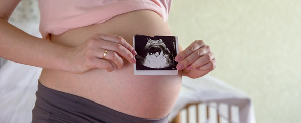 Big pregnant tummy and woman's hands holding ultrasound image of healthy unborn baby. Women's health and people concept. Maternity prenatal care and woman pregnancy concept. Panoramic banner. - obrazy, fototapety, plakaty