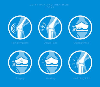 Set Of Icons Of The Joints And Their Treatment Cartilage Damage,  Arthritis, Osteoarthritis, Restoration Of Cartilage, Joints Pain. Flat Icons In A Round.