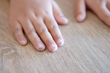 Obraz na płótnie Canvas dirty and black nails and smelly with long nails on fingernail and child or kid hand with ugly and unclean to bacteria on wood table from play