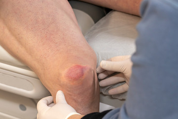 Ärztin untersucht Knieverletzung