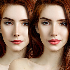 Lips of young redhead woman before and after augmentation.