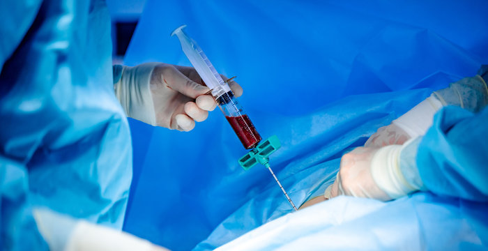 Platelet-Rich plasma preparation. Plasma in syringe. Modern equipment in operating room.