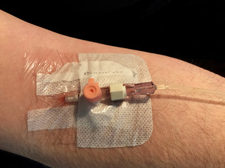 Cannula Inside Elbow 3