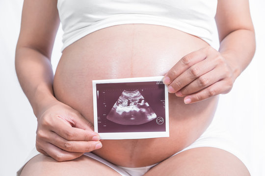 Close up of pregnant woman holding ultrasound scan
