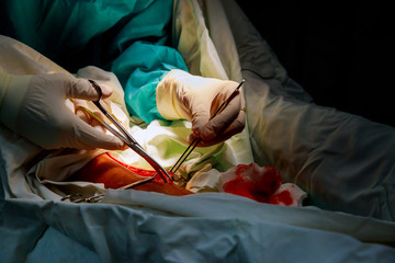 Surgeon using Mayo scissors to cut through tougher tissue in operating room in hospital.