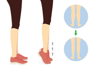 Workout diagram about Calves reduction with toe stand exercise. Illustration about slim leg with workout.