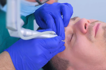 Surgeon removes papillomas on eyelid for man patient with laser in clinic, face closeup. Doctor making laser removal of growths on eyes skin, cosmetic one day surgery. Surgical cure.