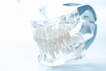 Dental model