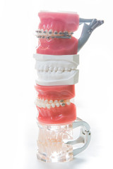 Dental model