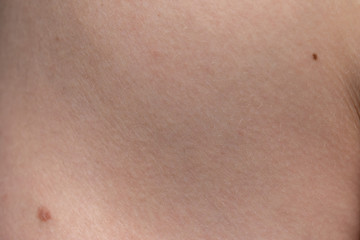Texture of human's skin with nevus, closeup photo