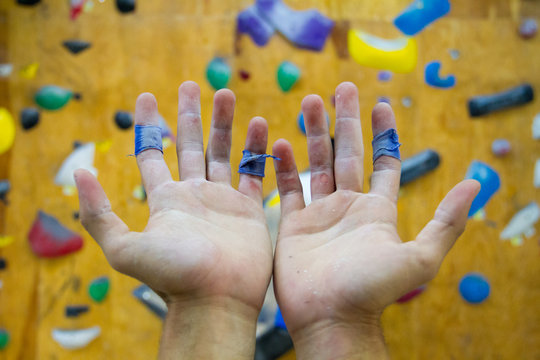 Wounded Climber Hands 