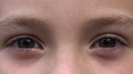 The eyes of a five year old girl Express emotion