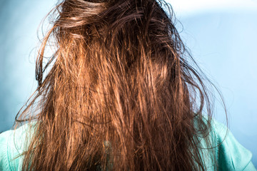 portrait of a girl with dirty, greasy, disheveled hair and problematic scalp. On a blue background