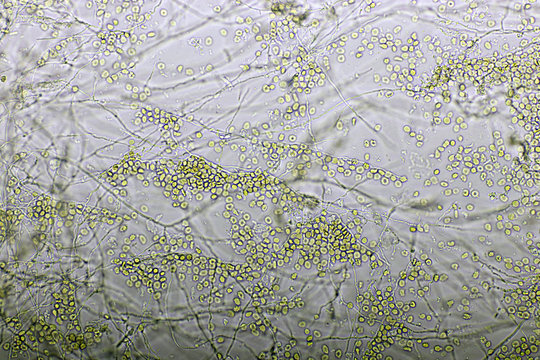 Picture of fungus and red blood cells in hemoculture tube, analyze by microscope 400x, specimen from HIV/AIDS patient