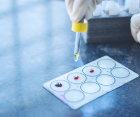 Close up, Hands testing Blood group called Protocol of ABO Blood grouping or testing, Adding...