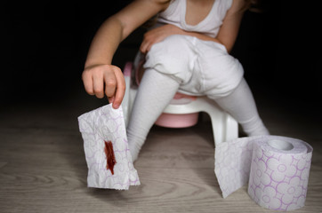 Fototapeta na wymiar The child has stomach problems, he sits on the toilet, he has diarrhea, constipation or hemorrhoids. A child with pantyhose lowered sits on a pot and holds bloody toilet paper in his hands. Digestive 